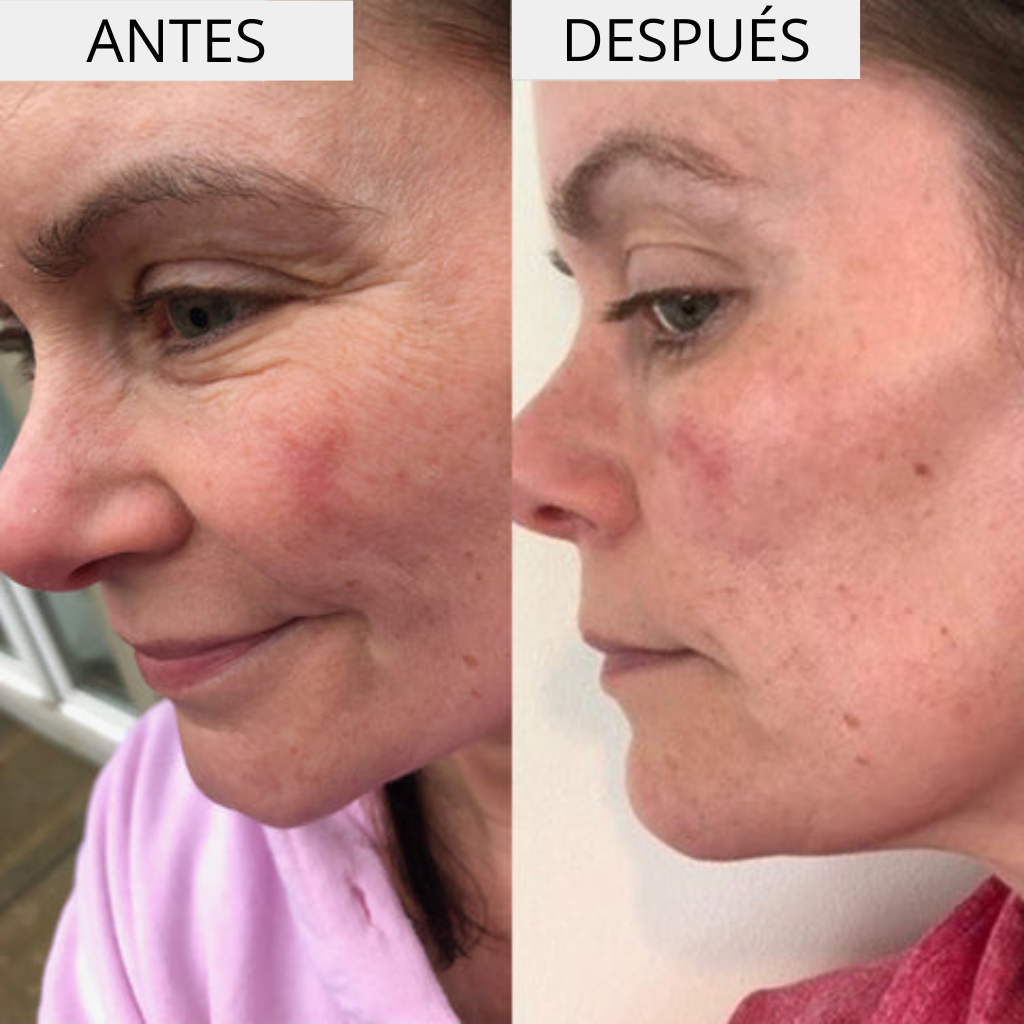 HYDRA + CREMA HIDRATANTE