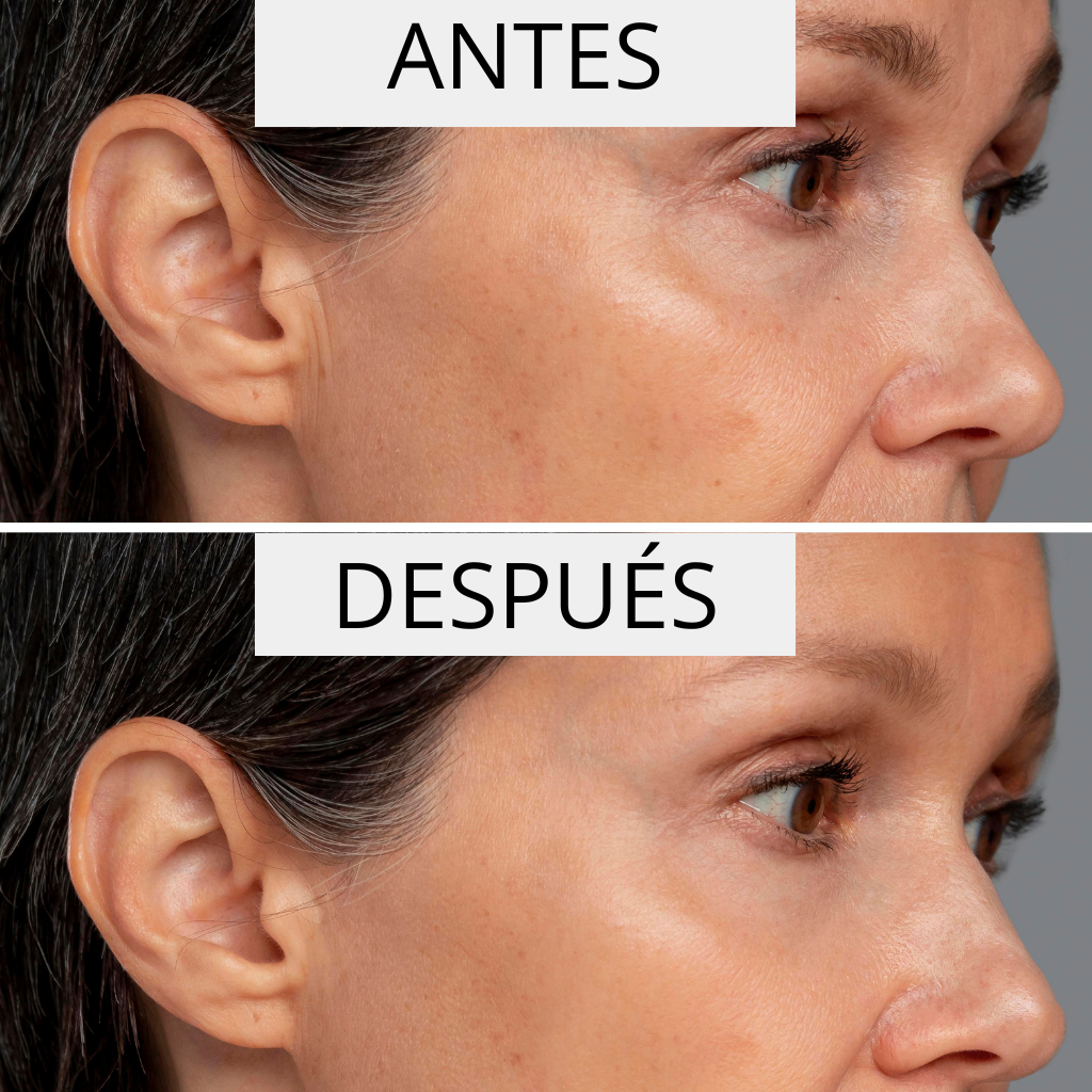 ΚΡΕΜΑ ΚΑΤΑ ΤΩΝ ΡΥΤΙΔΩΝ PERPETUA  ( 50ml )