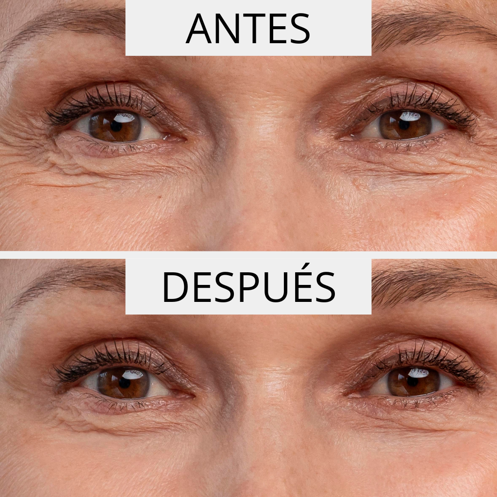 ΚΡΕΜΑ ΚΑΤΑ ΤΩΝ ΡΥΤΙΔΩΝ PERPETUA  ( 50ml )