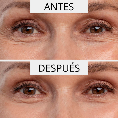 ΚΡΕΜΑ ΚΑΤΑ ΤΩΝ ΡΥΤΙΔΩΝ PERPETUA  ( 50ml )