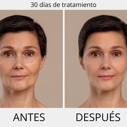 ΚΡΕΜΑ ΚΑΤΑ ΤΩΝ ΡΥΤΙΔΩΝ PERPETUA  ( 50ml )