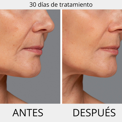 ΚΡΕΜΑ ΚΑΤΑ ΤΩΝ ΡΥΤΙΔΩΝ PERPETUA  ( 50ml )