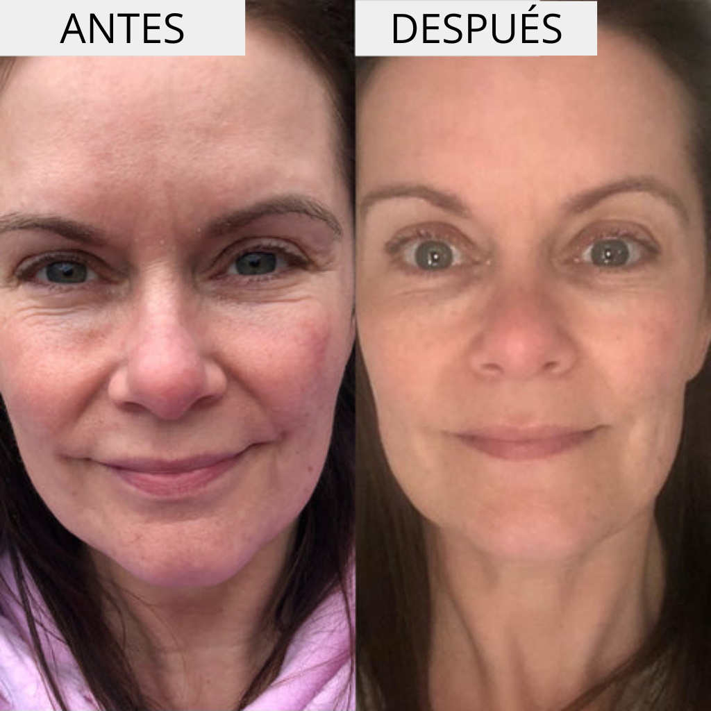 HYDRA +  CREMA HIDRATANTE