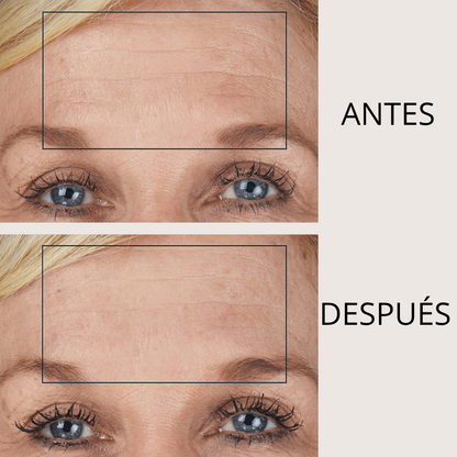 PARCHE LIFTEA ANTIARRUGAS