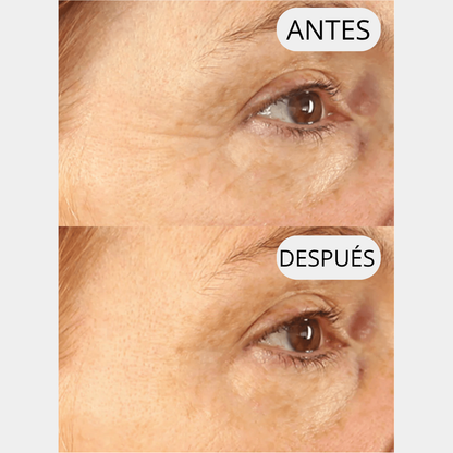 PARCHE LIFTEA ANTIARRUGAS