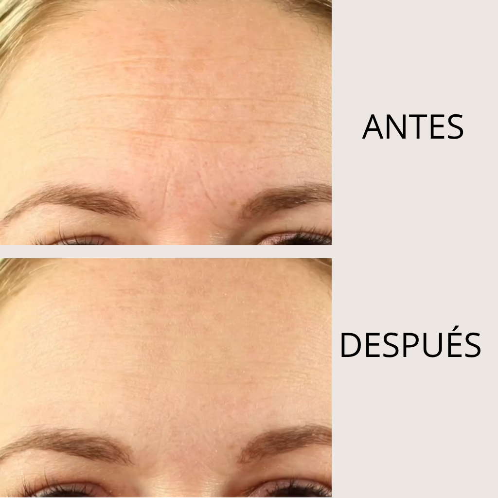 PARCHE LIFTEA ANTIARRUGAS