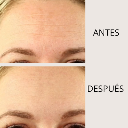 PARCHE LIFTEA ANTIARRUGAS