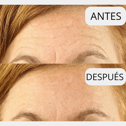 PARCHE LIFTEA ANTIARRUGAS