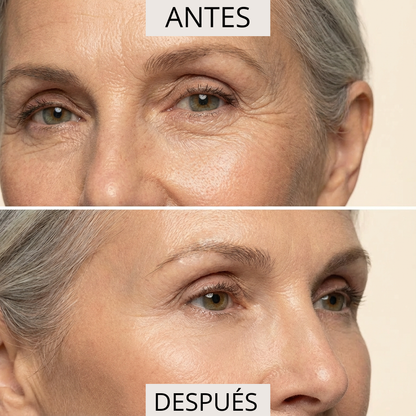 ΚΡΕΜΑ ΚΑΤΑ ΤΩΝ ΡΥΤΙΔΩΝ PERPETUA  ( 50ml )